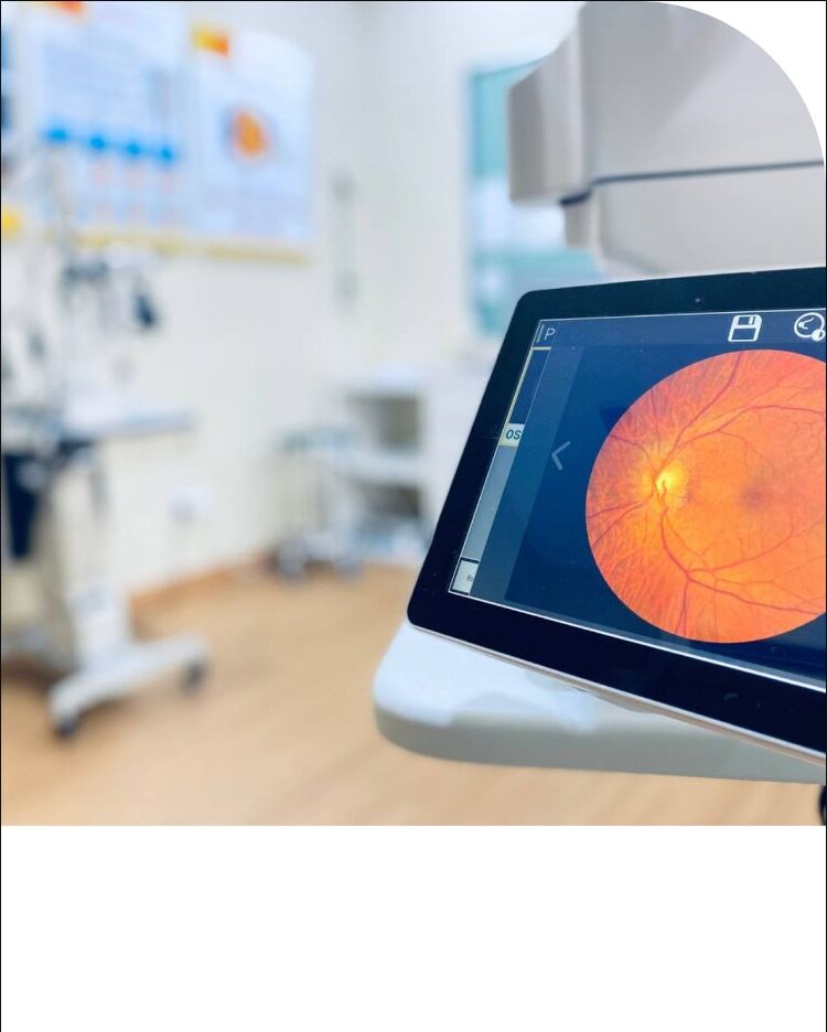 Peralatan pemeriksaan retina di IRIS Optometry